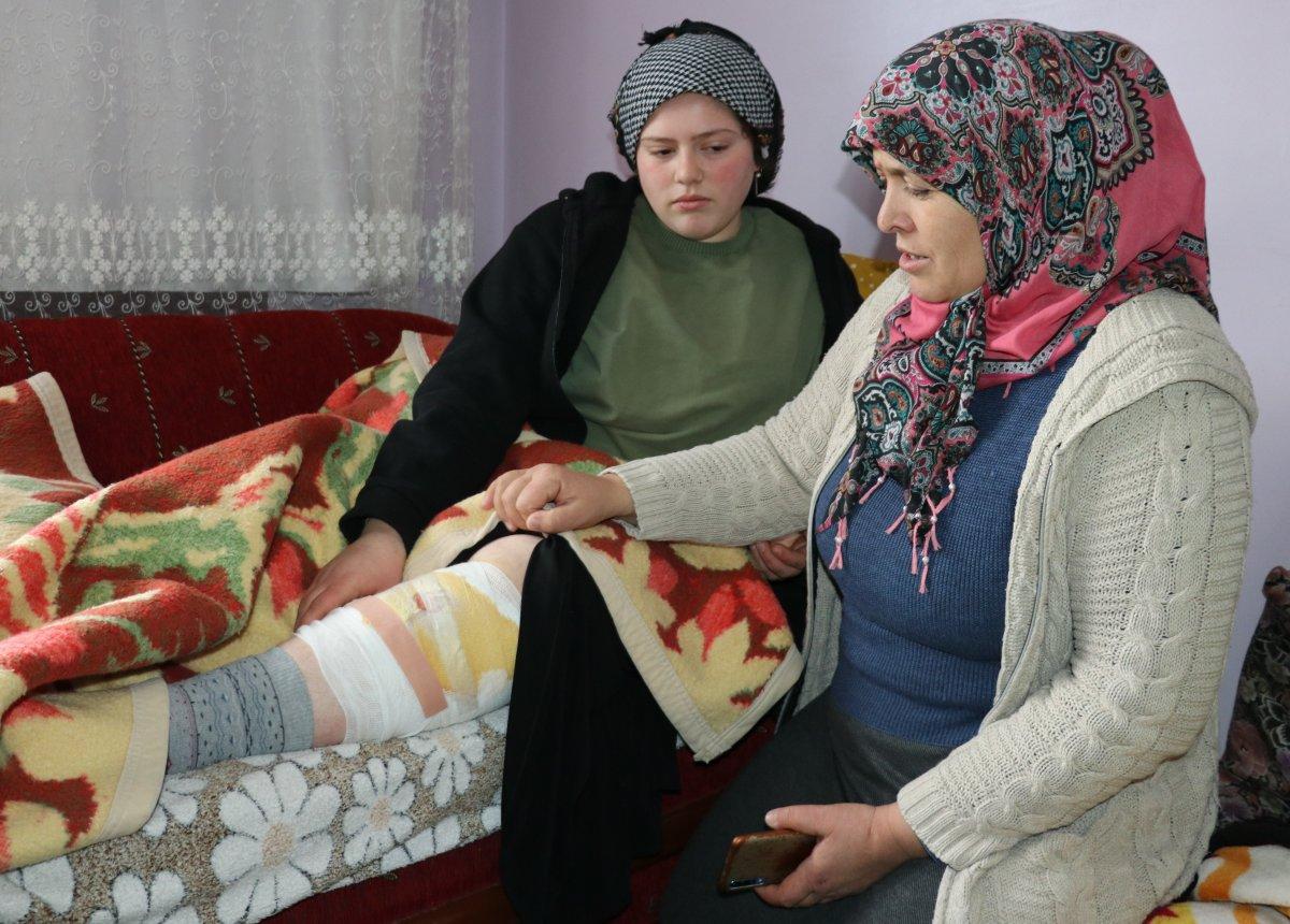 Van'da köpek dehşeti: Genç kızın bacağı parçalandı