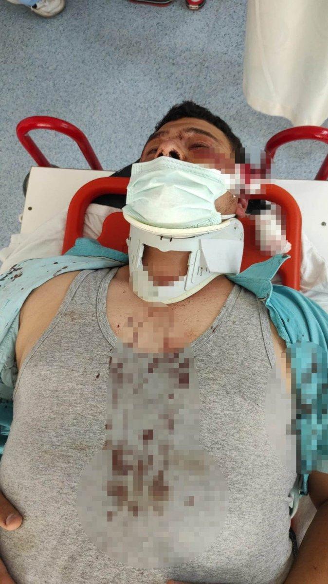 Kocaeli'de Lütfü Türkkan'ın adamlarının darbettiği muhabirin yara izleri geçmeyecek