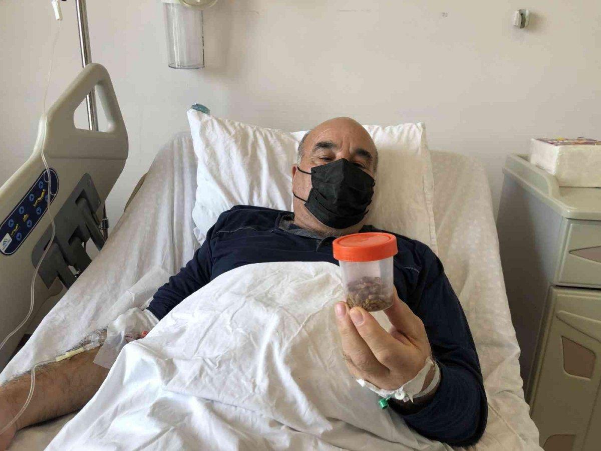 Sakarya’da, böbreğinden 1.200 taş çıkarıldı