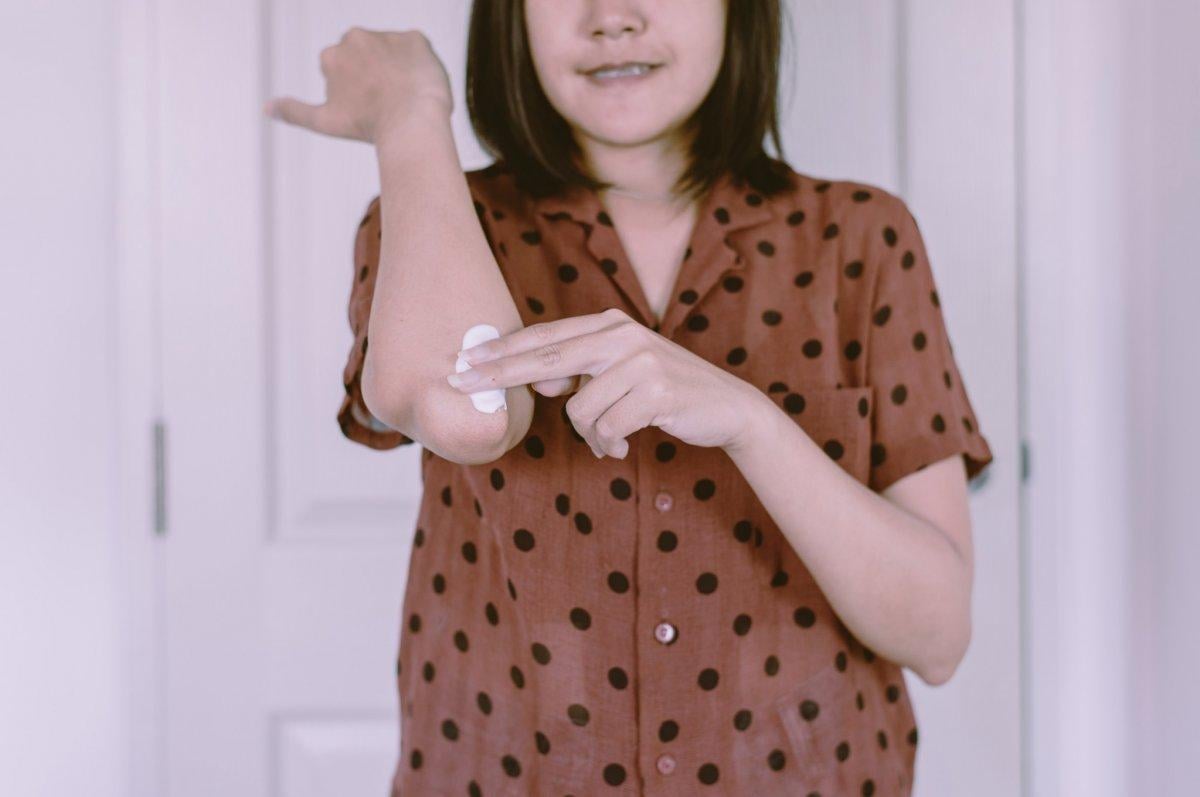 Egzama nedir ve nasıl tedavi edilir