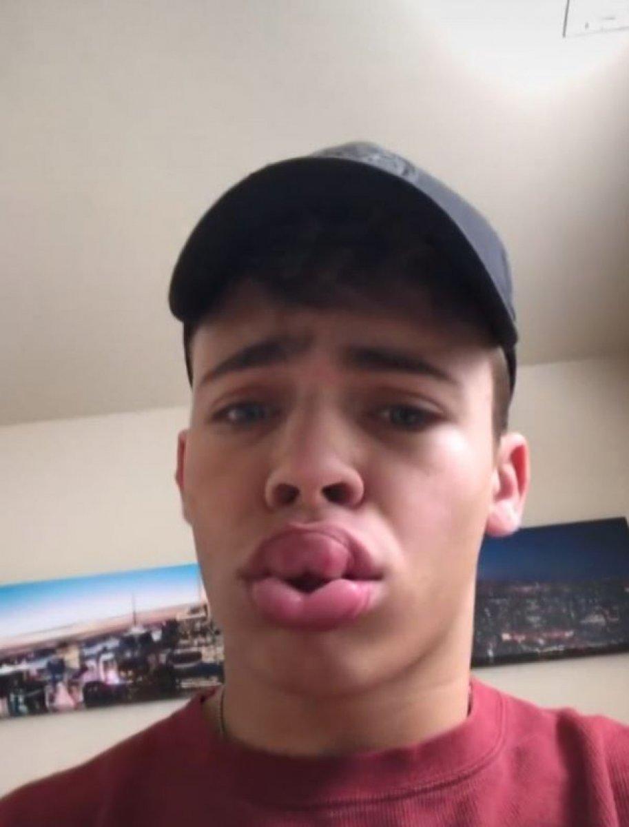 Gençler için tehlike çanları çalıyor: Evde estetik akımına uyarı