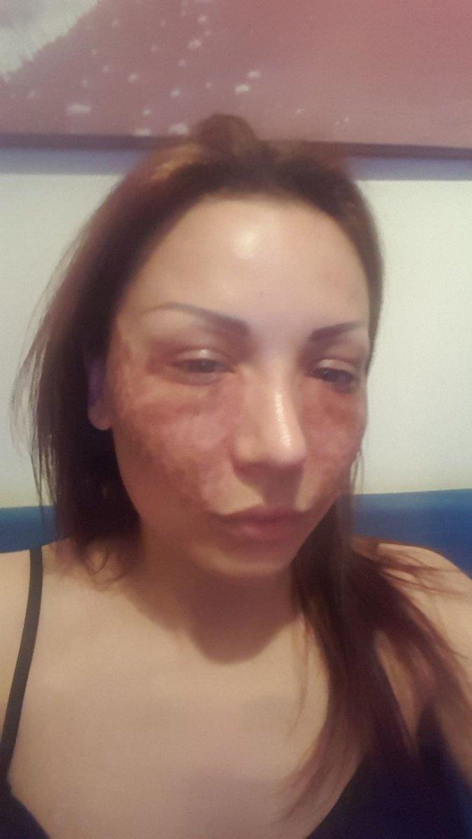 İstanbul’da örümcek estetiği iddiasına savunma