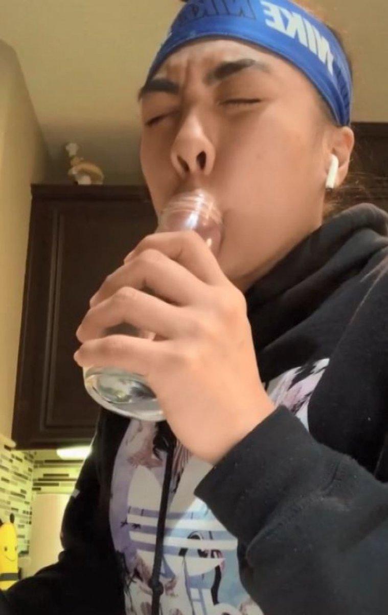 Gençler için tehlike çanları çalıyor: Evde estetik akımına uyarı