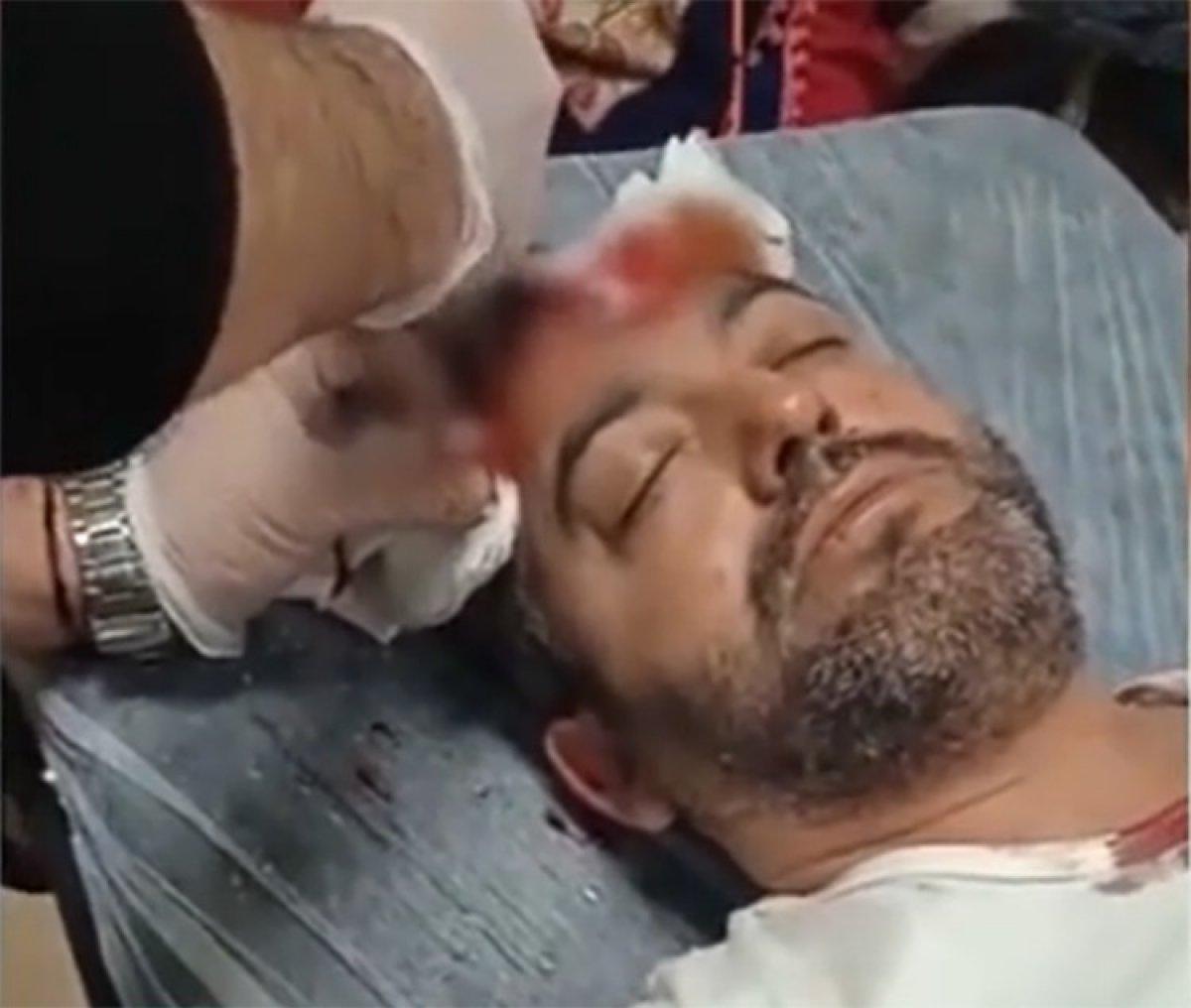 Küçükçekmece'de avukata beyzbol sopalı saldırı cezası belli oldu