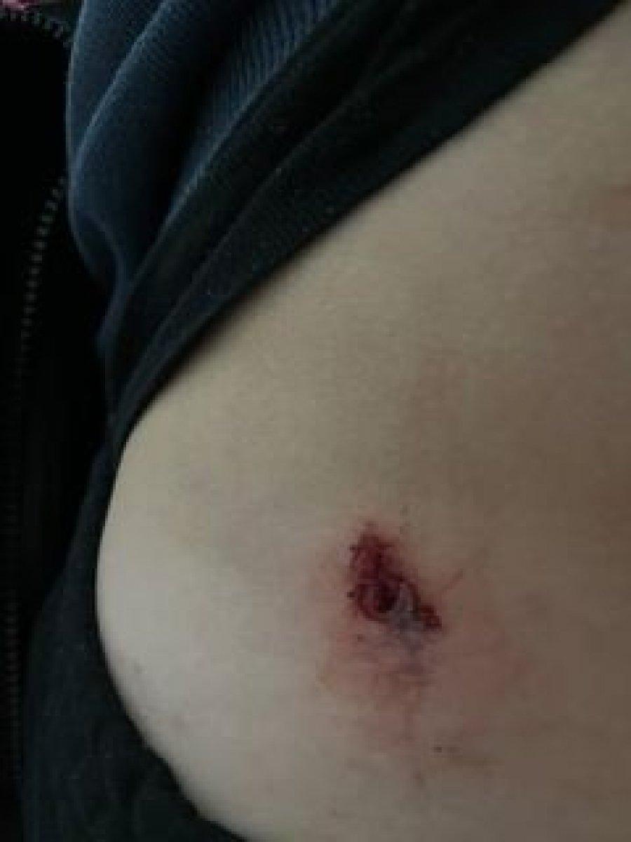 Denizli'de evinin terasında maganda kurşunun hedefi oldu