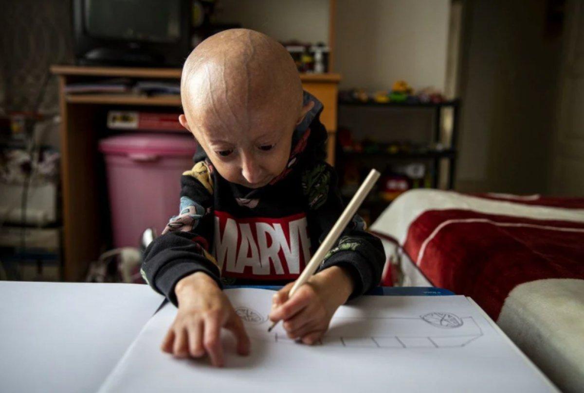 9 yaşındaki Veysel'in hayat mücadelesi