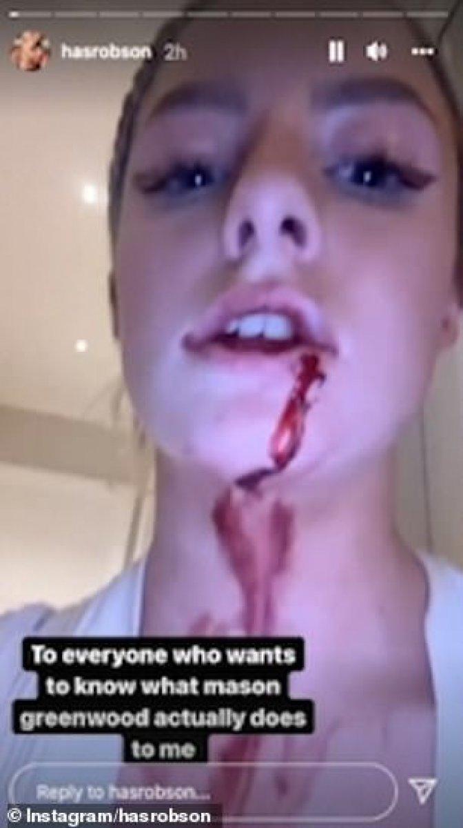 Manchester United'da forma giyen Mason Greenwood tutuklandı