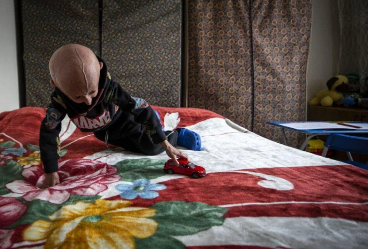 9 yaşındaki Veysel'in hayat mücadelesi