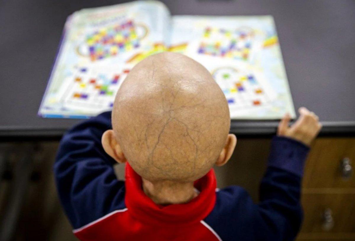 9 yaşındaki Veysel'in hayat mücadelesi