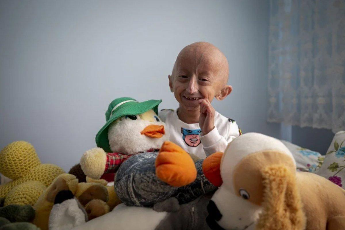 9 yaşındaki Veysel'in hayat mücadelesi