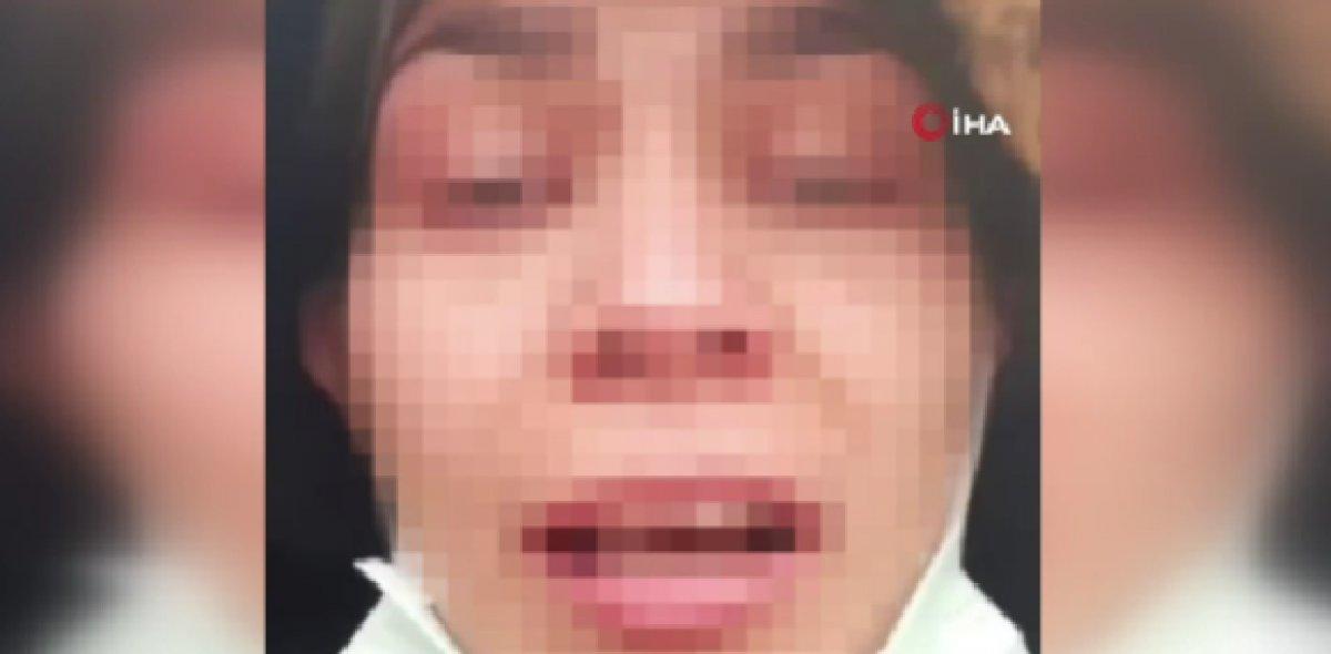 Sakarya'da eski eş mağduru: Ölmek istemiyorum