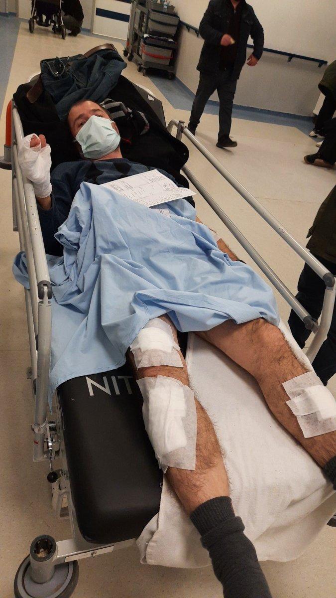 Ankara'da başıboş köpek saldırısına uğrayan adam ağır yaralandı