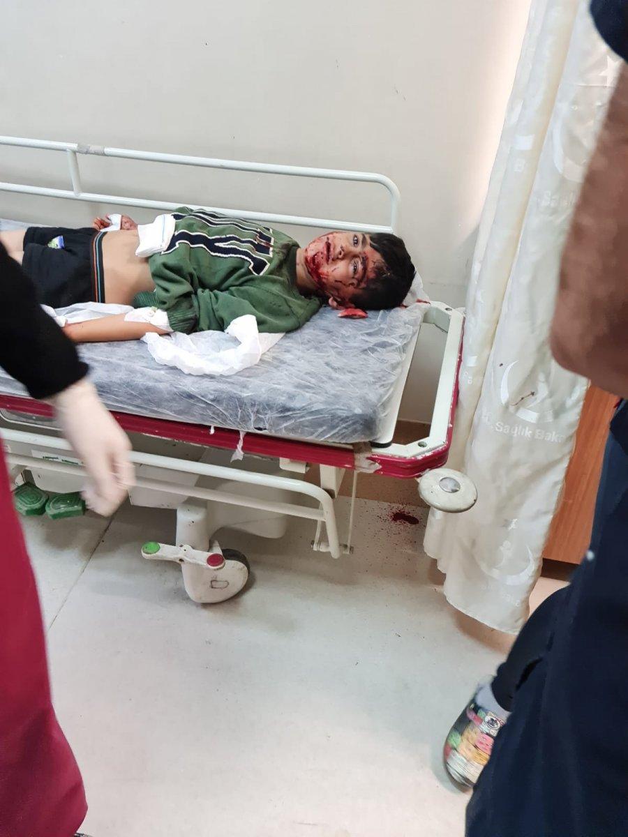 Mardin'de köpeklerin saldırısına uğrayan çocuk ağır yaralandı