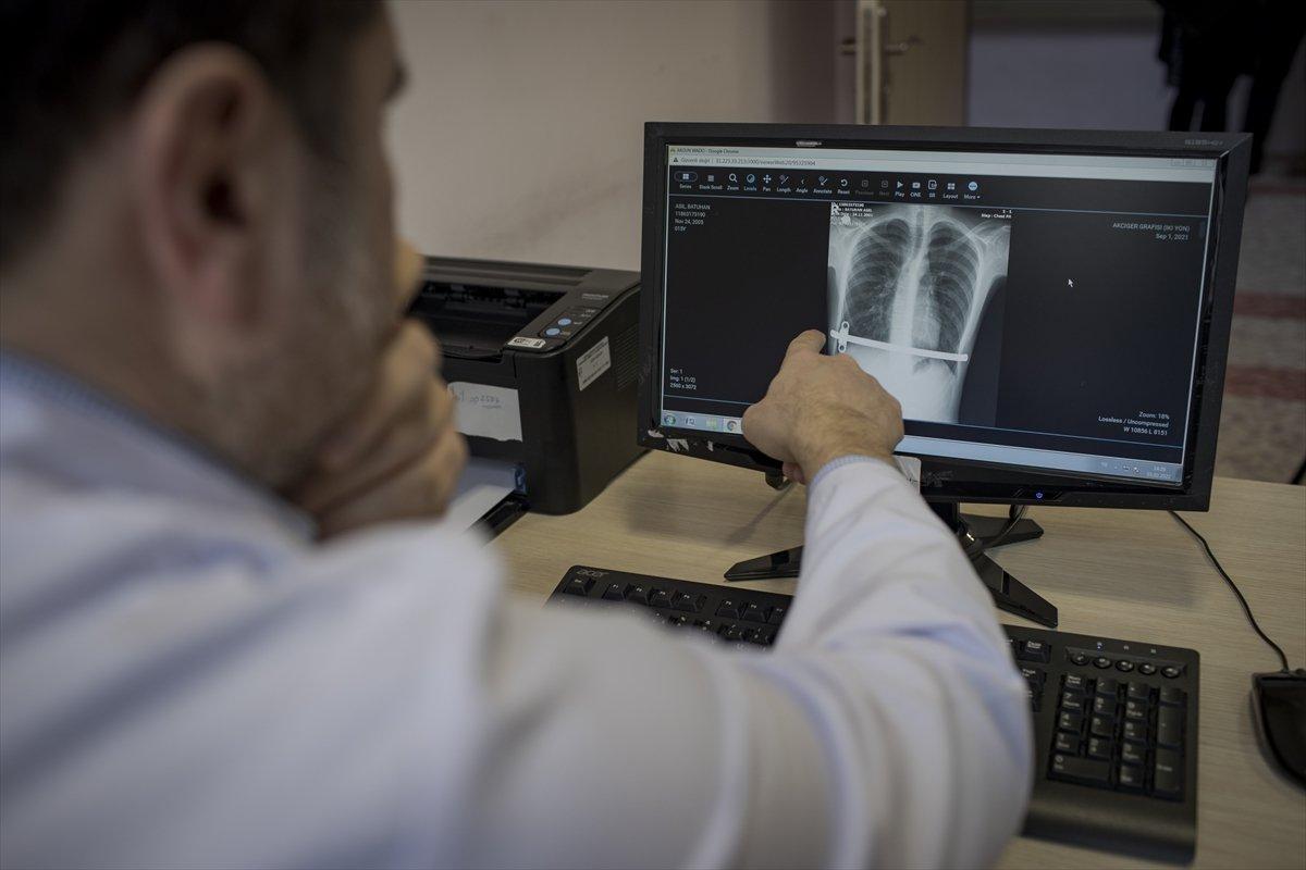 Ankara'da, kunduracı göğsü hastalığından kapalı ameliyat ile kurtuldu