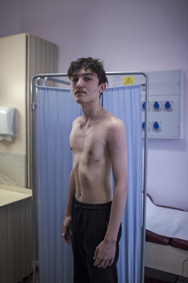 Ankara'da, kunduracı göğsü hastalığından kapalı ameliyat ile kurtuldu