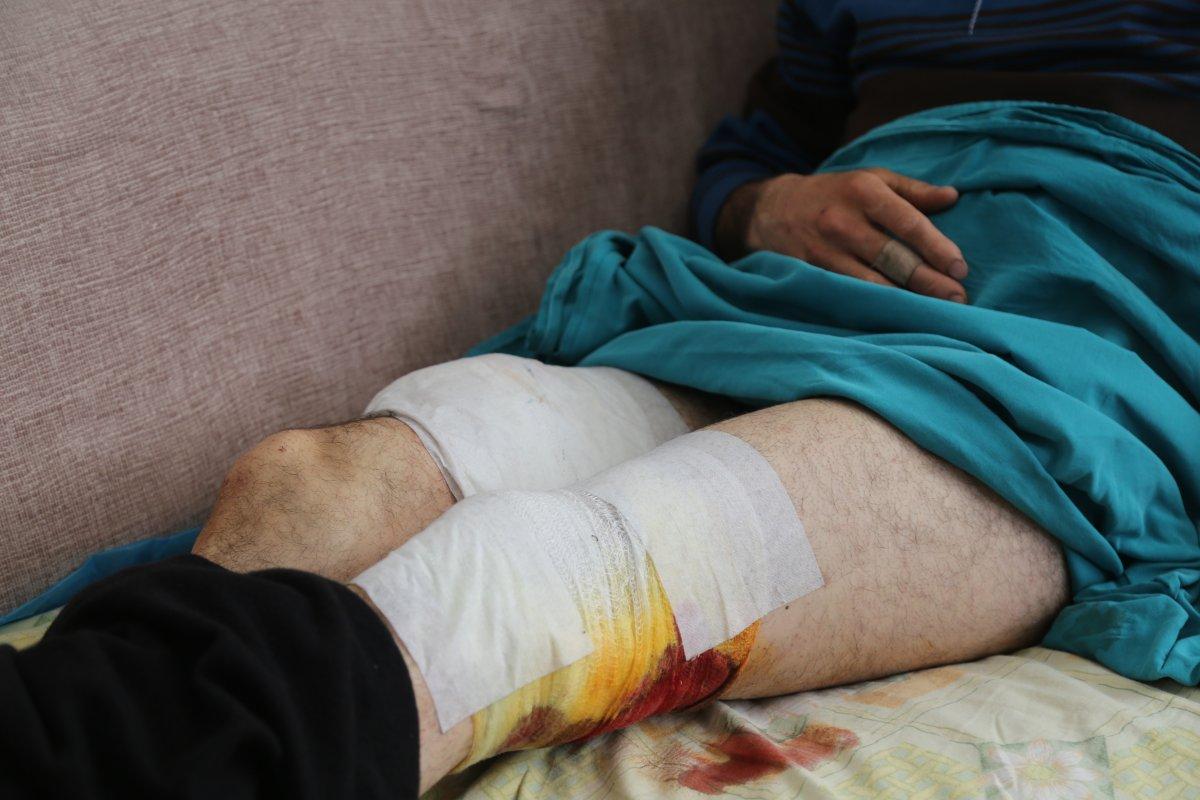 Artvin'de işitme engelliye ayı saldırdı