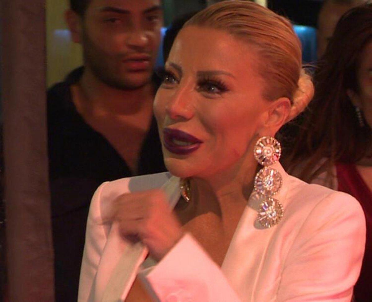 Gülşah Saraçoğlu dudağını göstermek istemedi