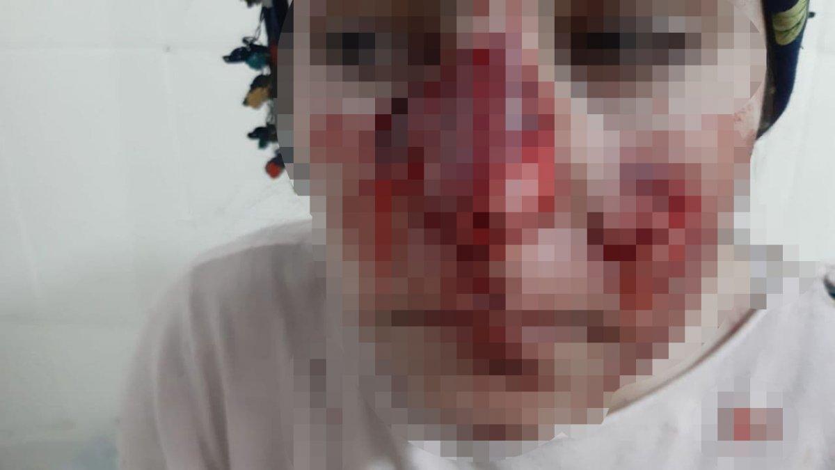 Mardin'de başıboş köpekler 3 kişiyi yaraladı