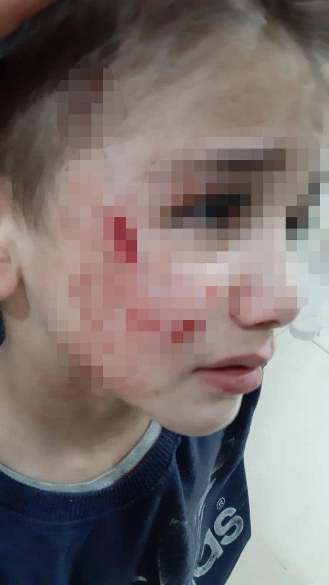 Mardin'de başıboş köpekler 3 kişiyi yaraladı