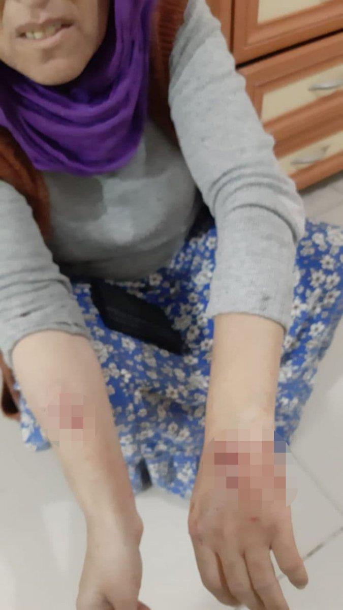 Mardin'de başıboş köpekler 3 kişiyi yaraladı