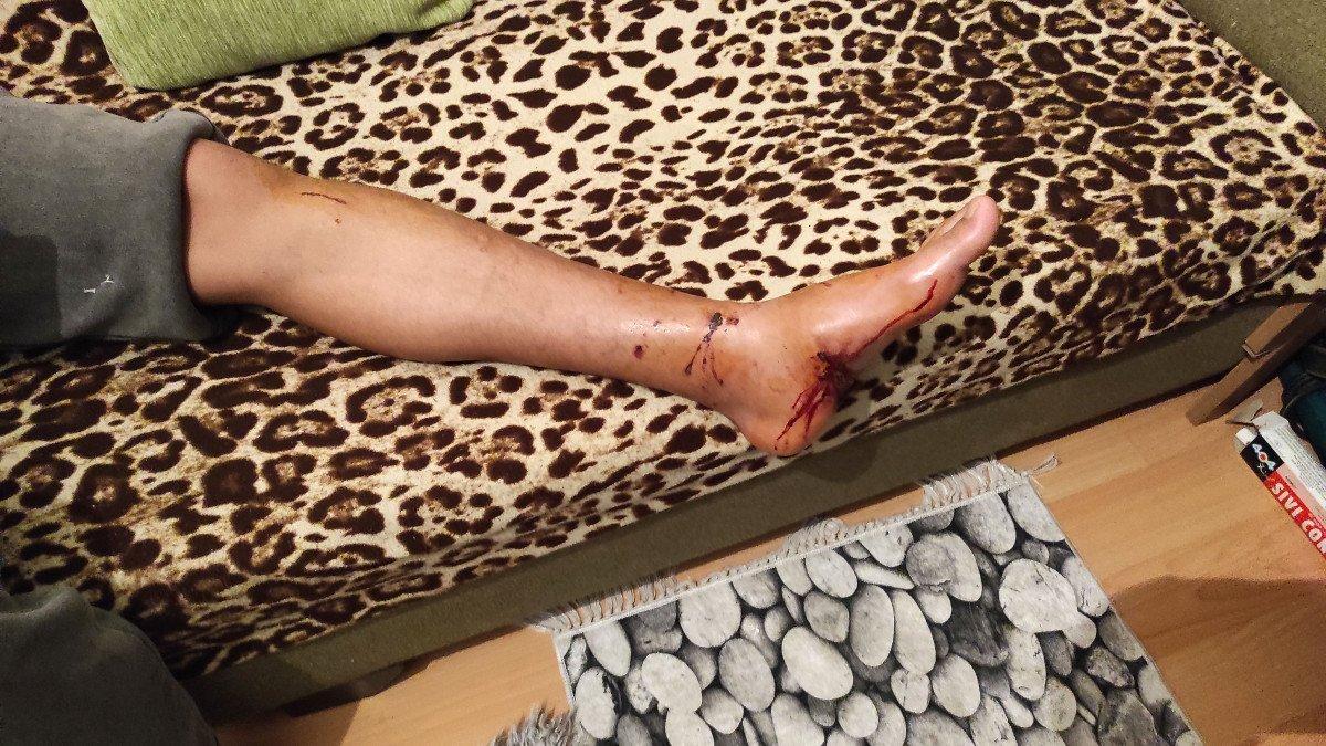 İstanbul'un göbeğinde pitbull dehşeti: Sahibi bıraktı 3 kişiye saldırdı