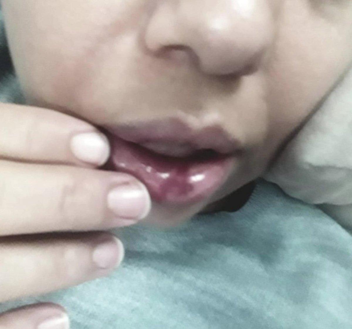 Kahramanmaraş'ta koca şiddetinden hastanede yatan kadının yardım çığlığı