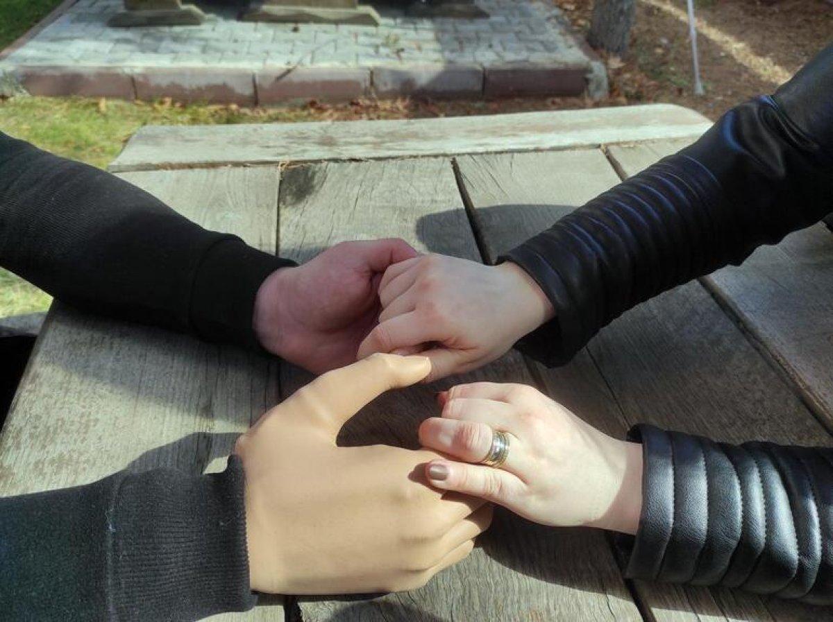 Pençe-Şimşek gazisi İbrahim Yüzer'in biyonik kolu da takıldı