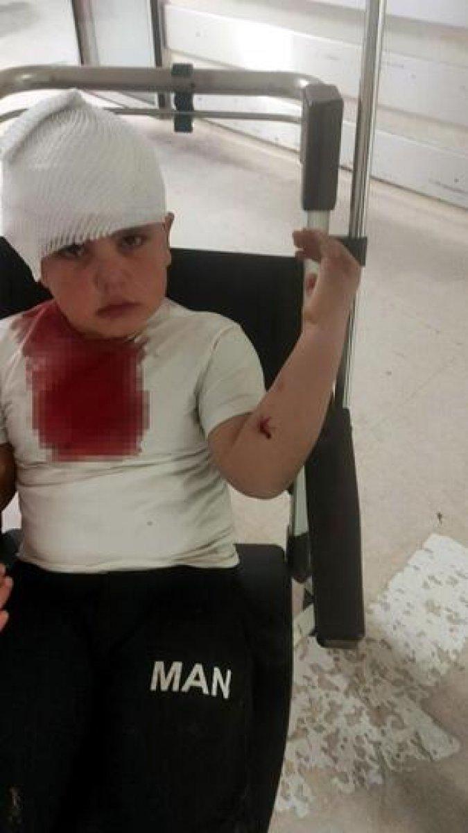 İzmir’de, 6 yaşındaki çocuğa pitbull melezi köpek saldırdı