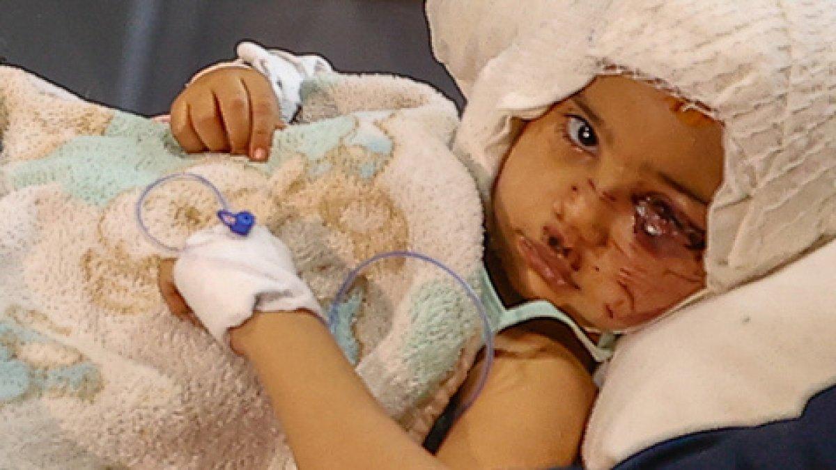 Asiye Ateş’in pitbull saldırısına uğramasına ilişkin davada 4 tahliye