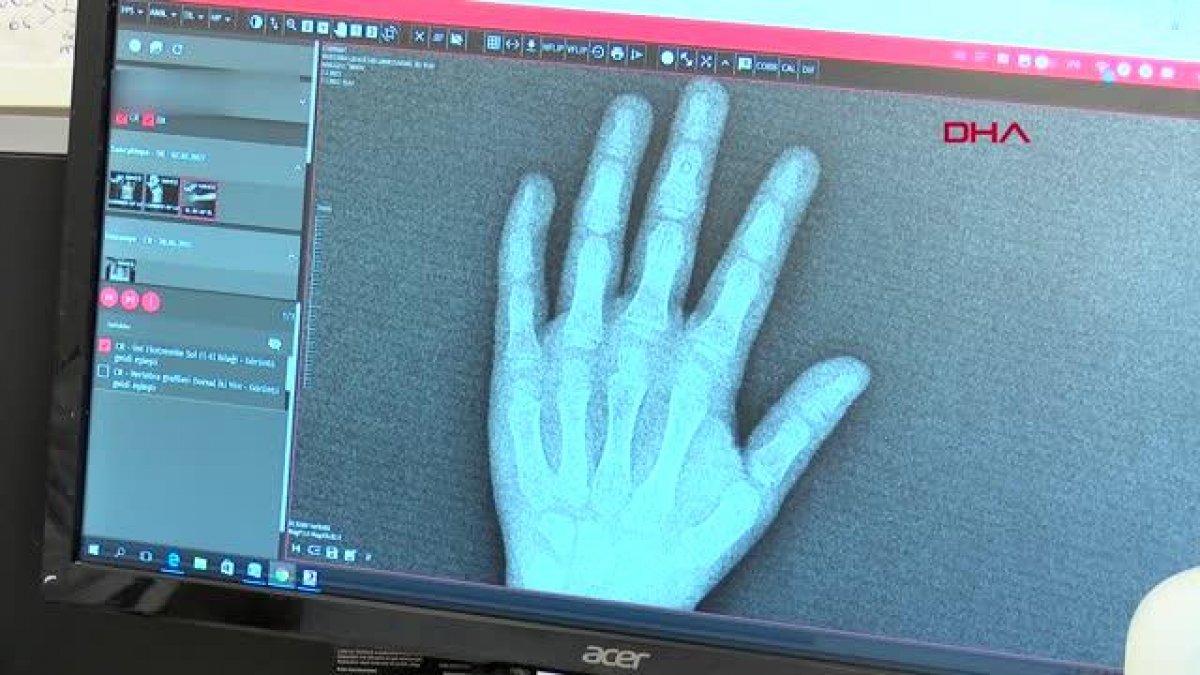 Bilinçsiz kullanılan vitaminler ve takviyeler, çocukları hasta ediyor