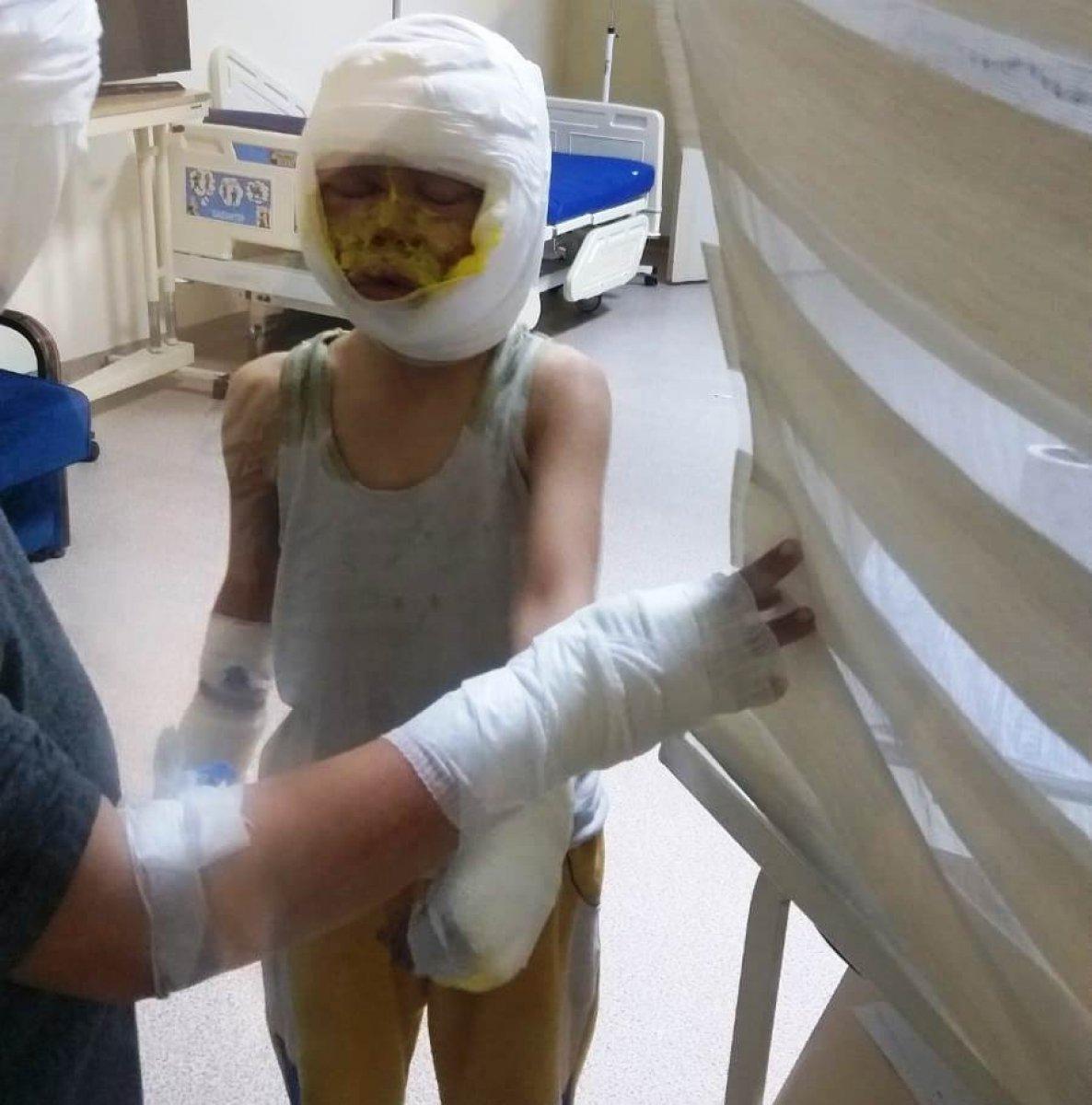 Gaziantep'te bomba gibi patlayan teneke ölümden döndürdü