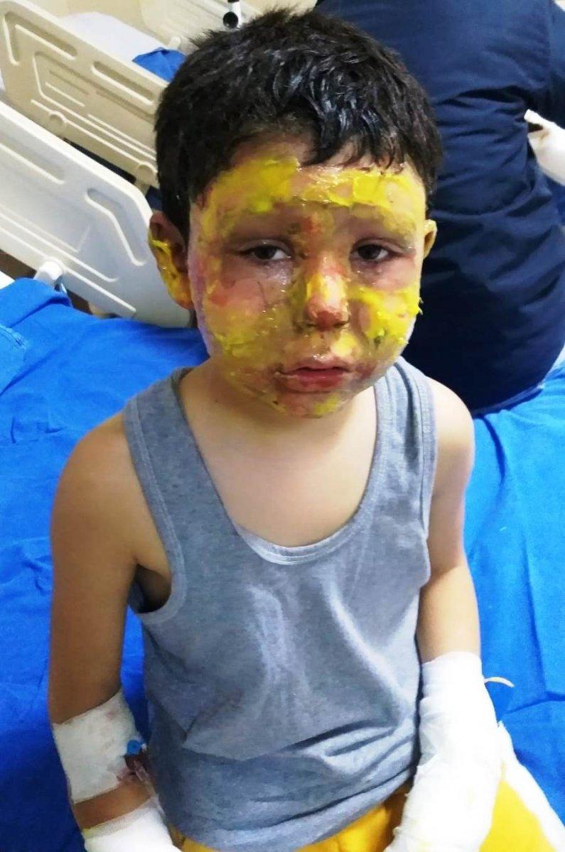 Gaziantep'te bomba gibi patlayan teneke ölümden döndürdü