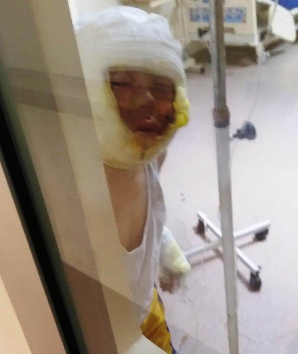 Gaziantep'te bomba gibi patlayan teneke ölümden döndürdü