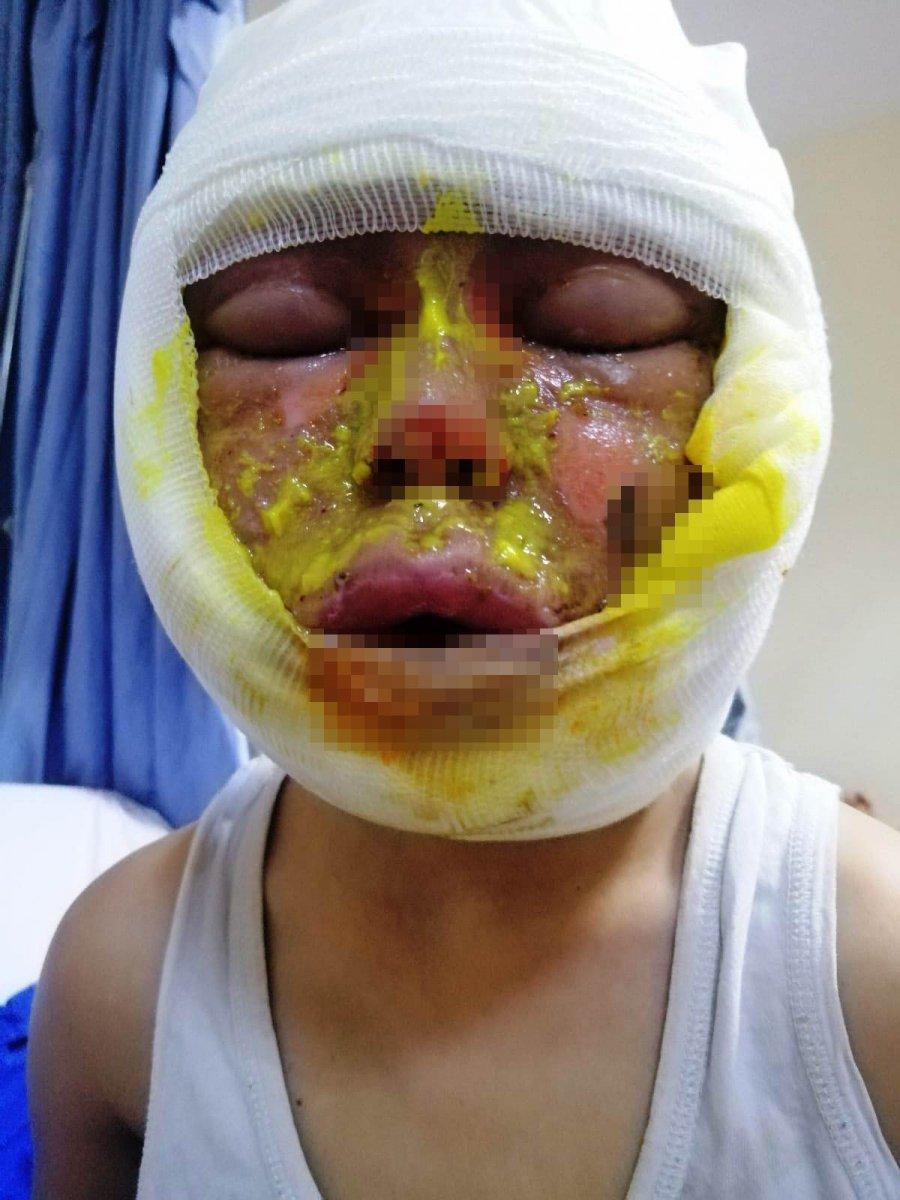 Gaziantep'te bomba gibi patlayan teneke ölümden döndürdü