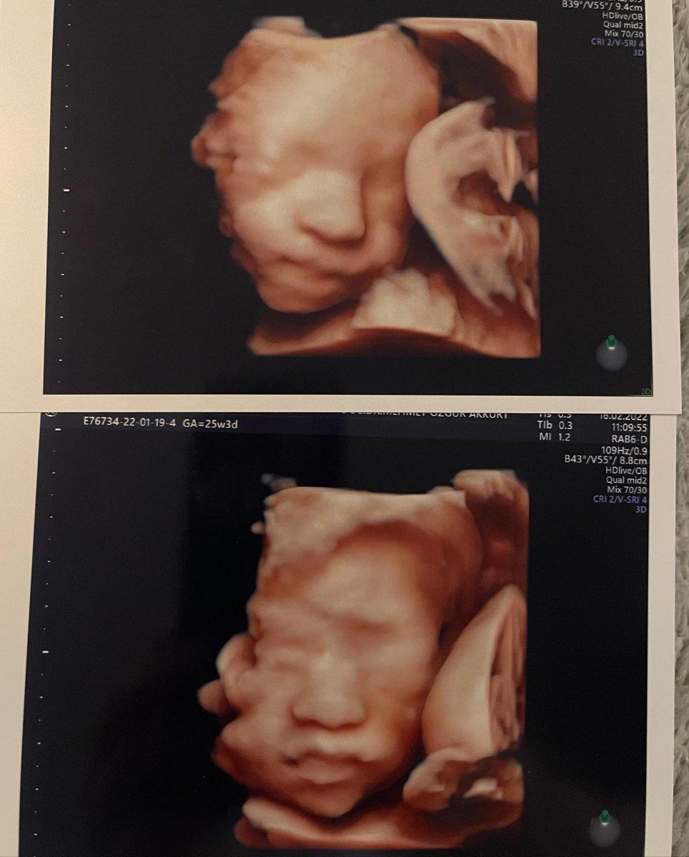 Seray Sever üzücü haberi verdi: Babamı bize bağışla