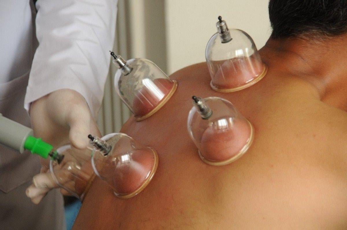 Hacamat günleri 2022: Mart ayında hangi günler hacamat yapılır