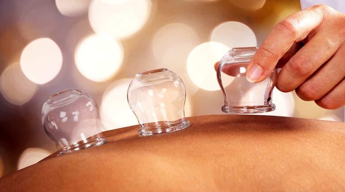 Hacamat günleri 2022: Mart ayında hangi günler hacamat yapılır