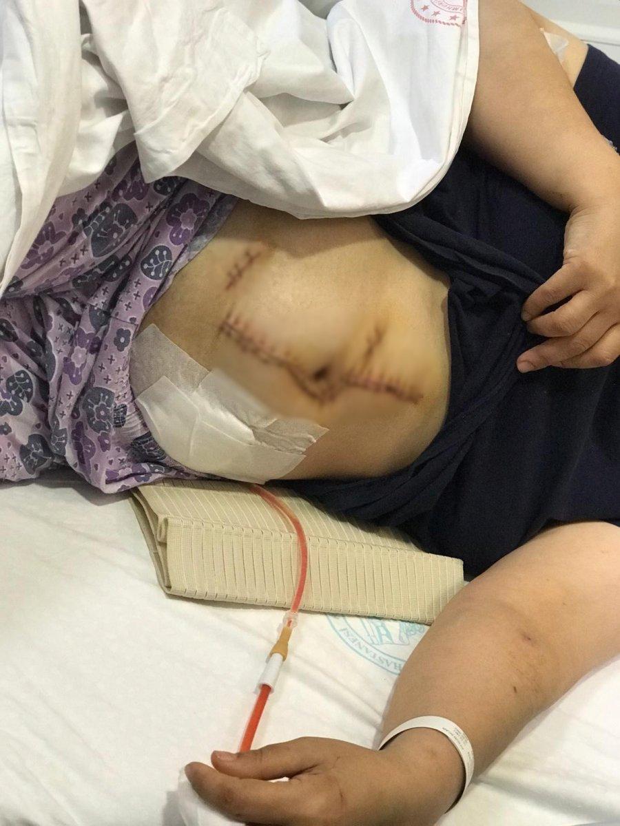 Sarıyer'deki kadın, kocasının bıçakladığı anları anlattı