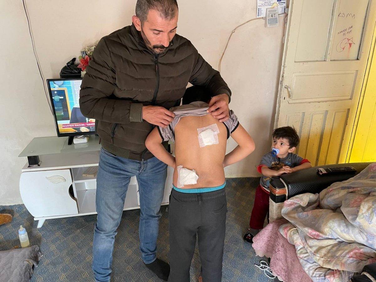 Sivas'ta başıboş köpekler çocuğa saldırdı