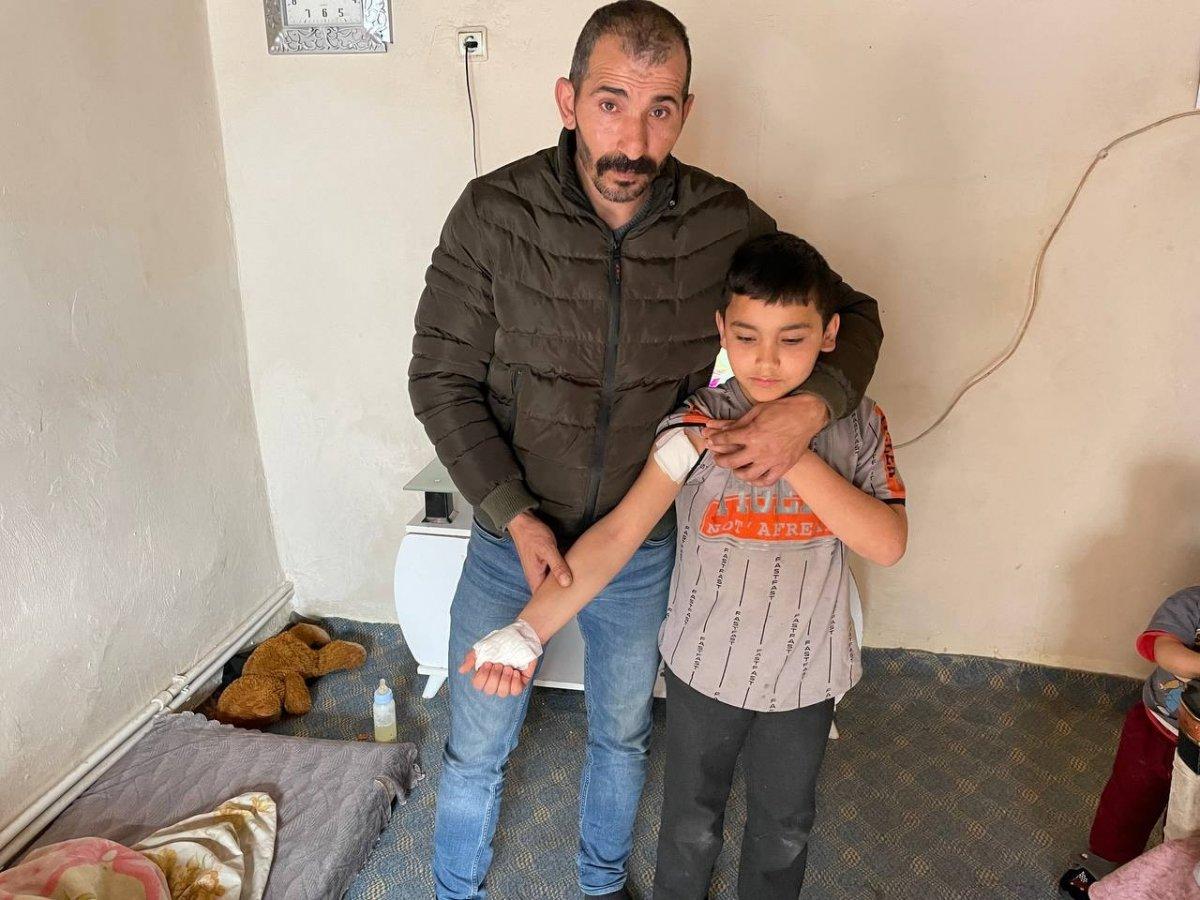 Sivas'ta başıboş köpekler çocuğa saldırdı