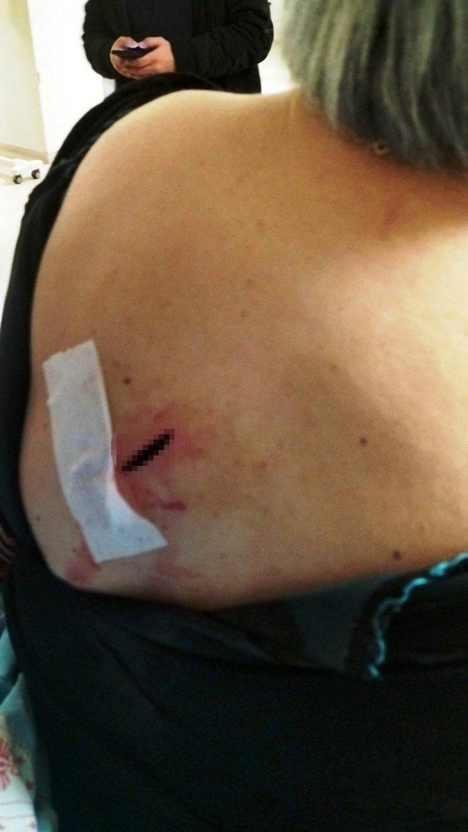 Antalya'da sokak ortasında bıçaklı saldırı