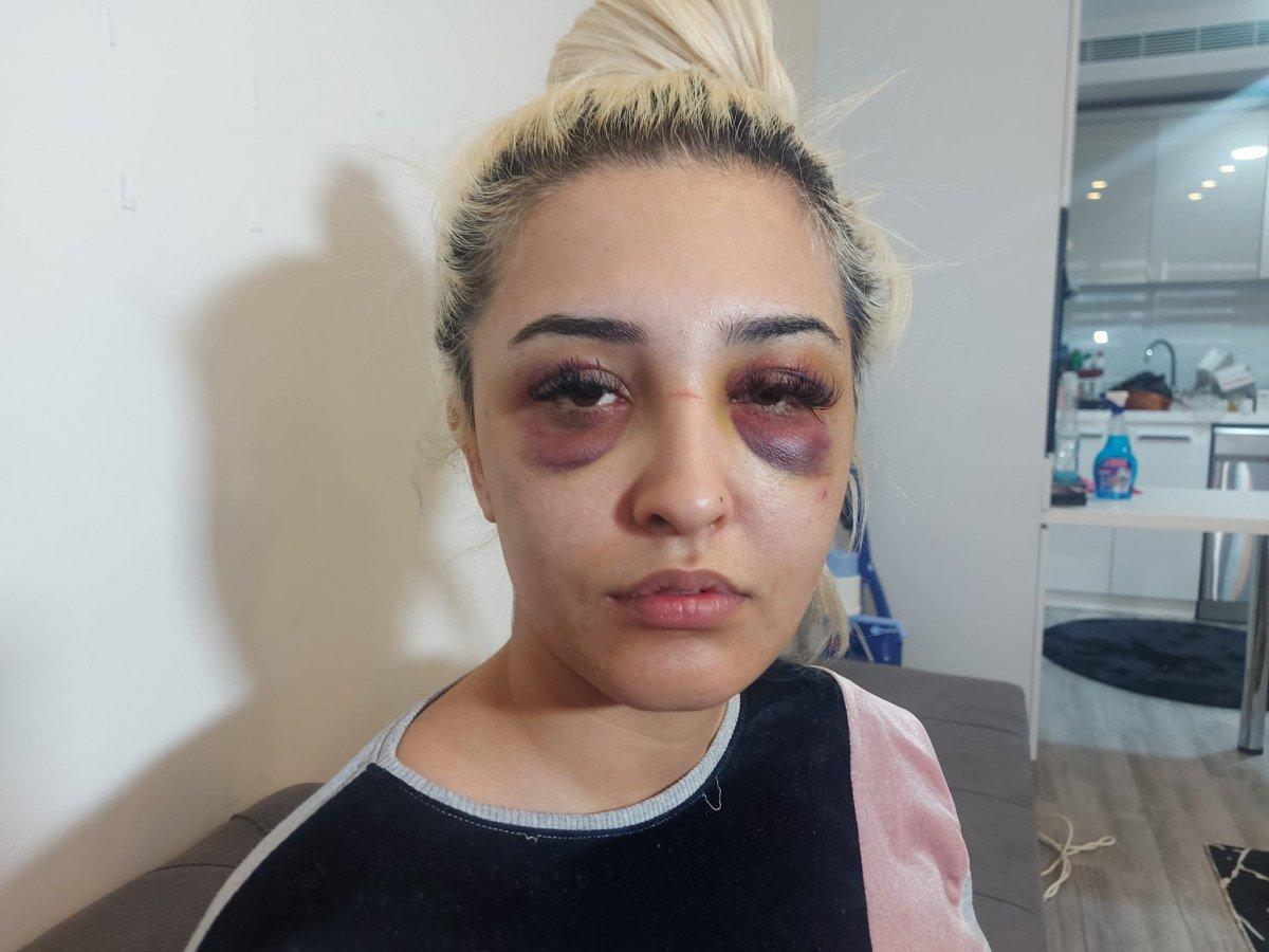 İzmir’de genç kadını eski sevgilisi darbetti