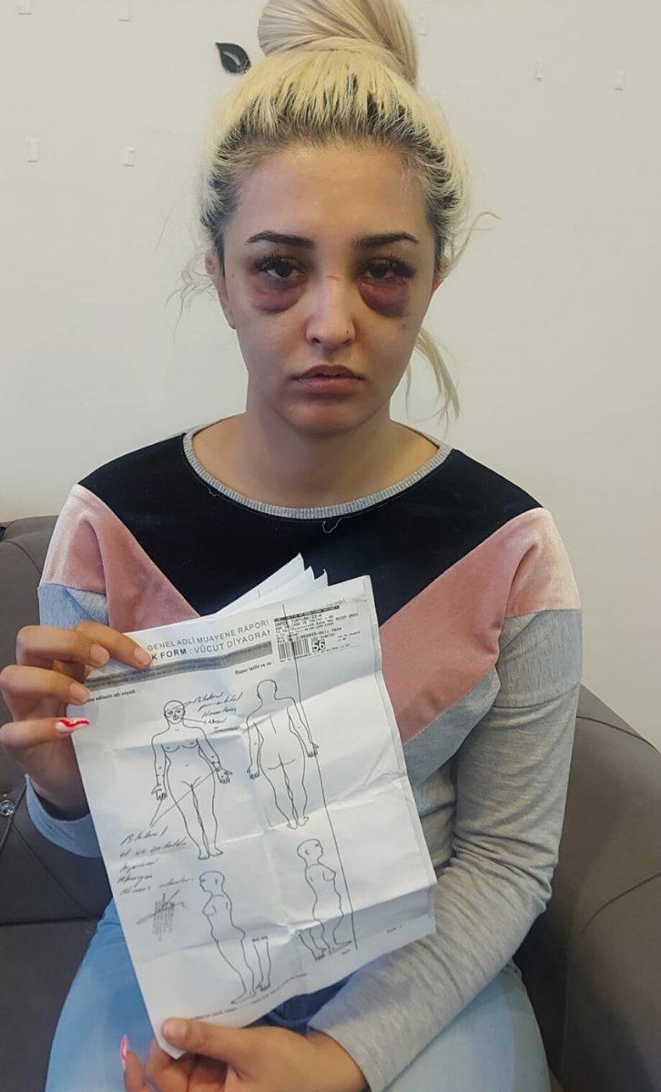 İzmir’de genç kadını eski sevgilisi darbetti