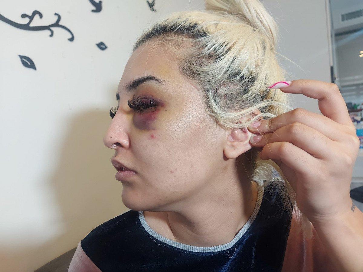 İzmir’de genç kadını eski sevgilisi darbetti