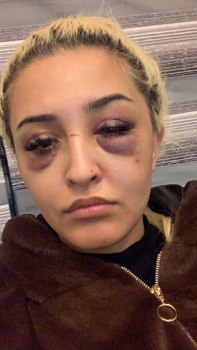 İzmir’de genç kadını eski sevgilisi darbetti