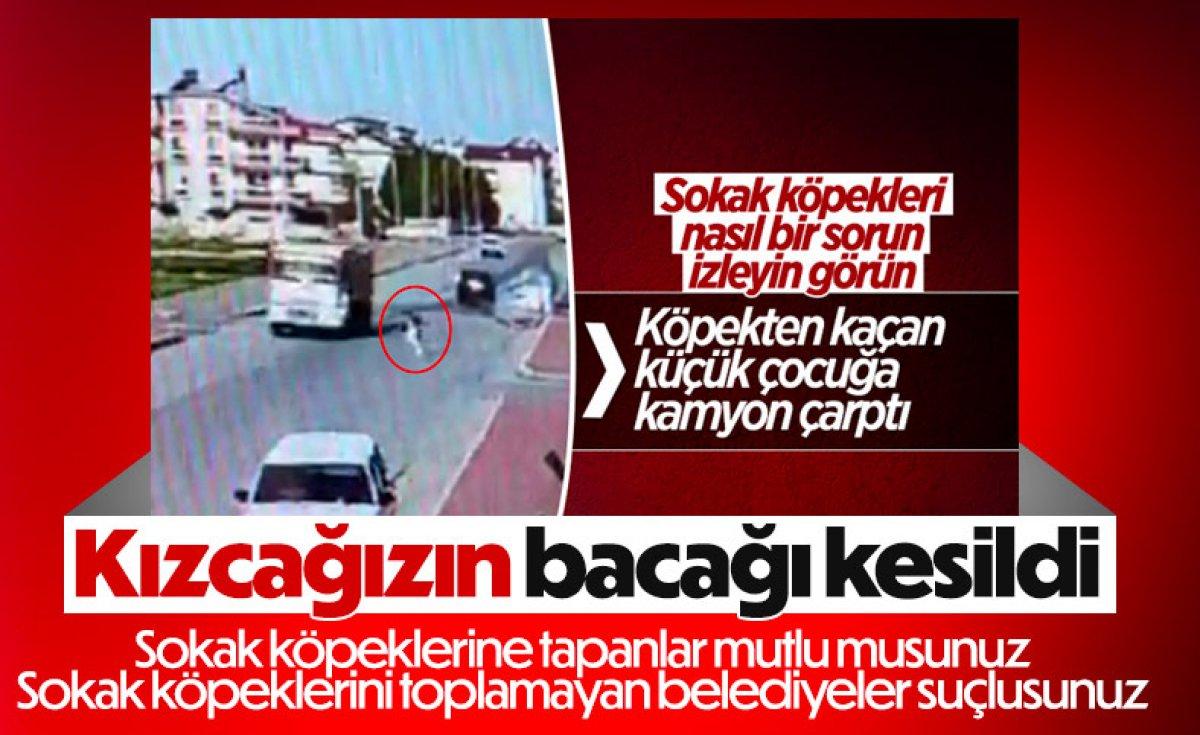 Köpekten kaçarken ayağından olan Mahra'nın beyin ölümü gerçekleşebilir