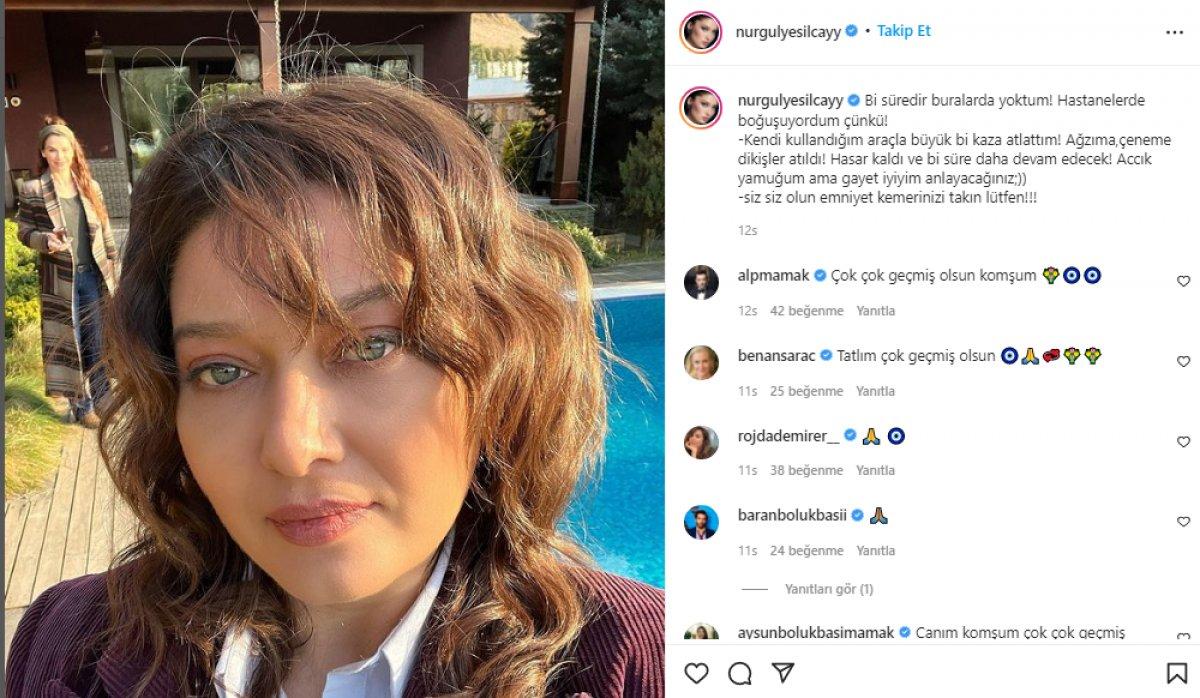 Nurgül Yeşilçay, kaza geçirdi