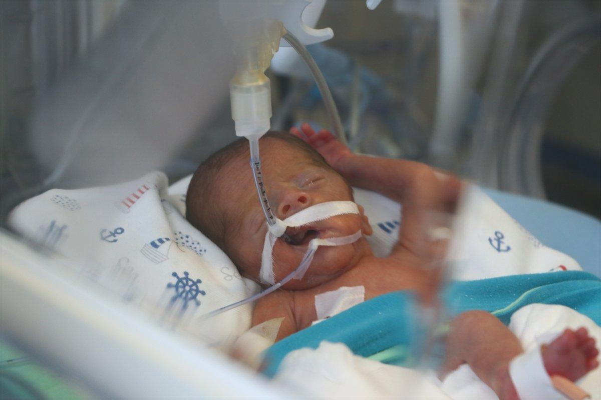 Tekirdağ'da 5,5 aylık doğan bebek kök hücreyle tedavi edildi