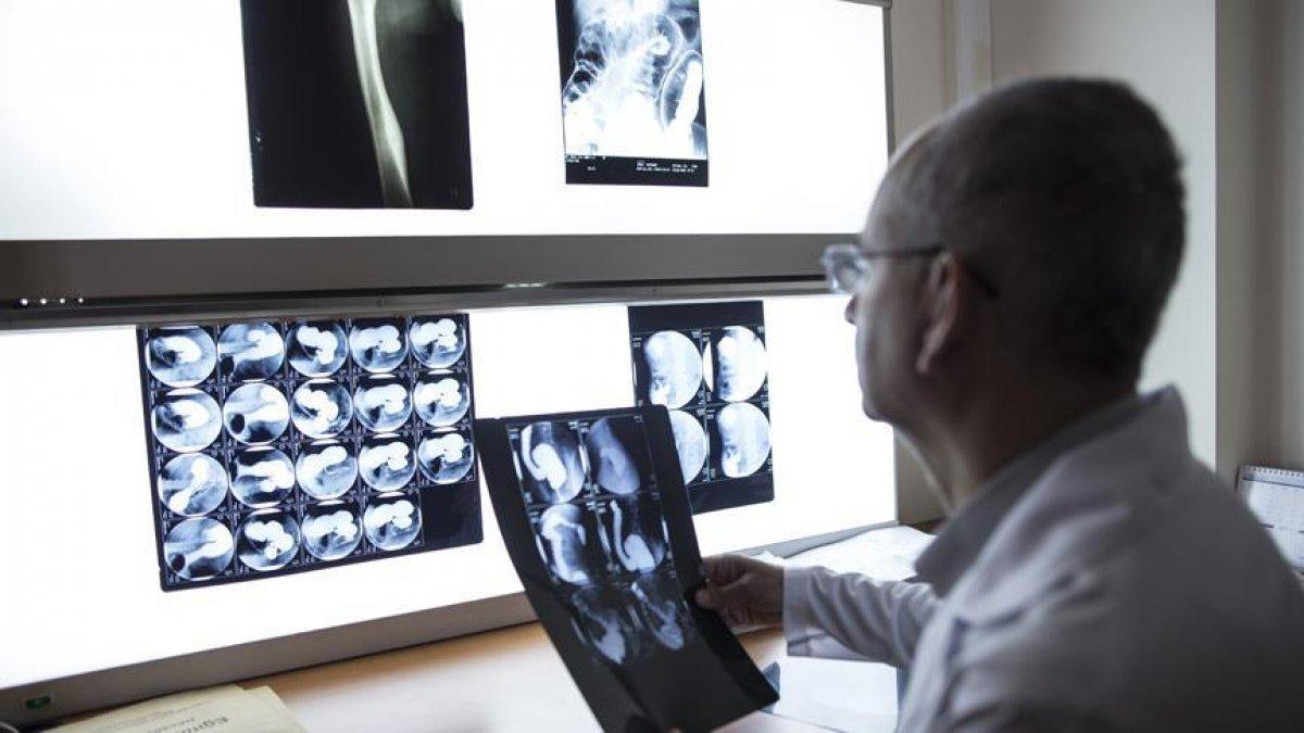 Doktorlardan uyarı: Epilepsi nöbeti geçirene soğan ya da kolonya koklatmayın