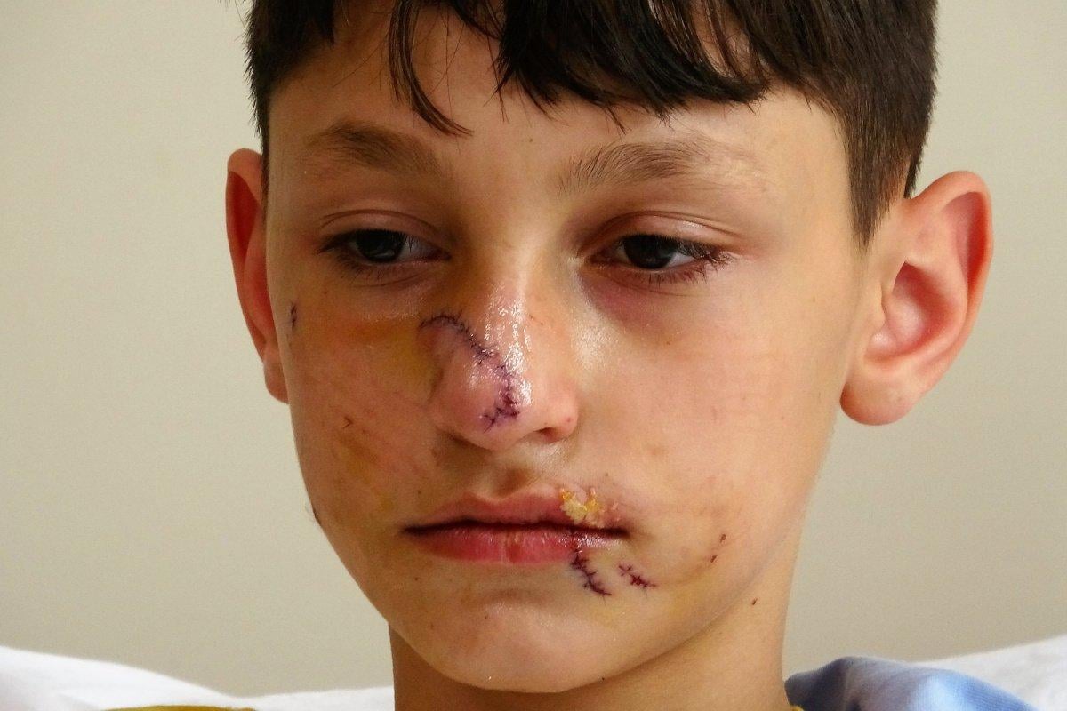 Yıldız Tilbe'den başıboş köpek çıkışı: Sevmek için bir sebep göremiyorum